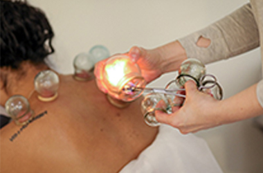 Therapeutic Cupping
