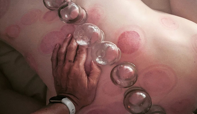 Swedish, Deep Tissue, Prenatal Massage and Therapeutic Cupping